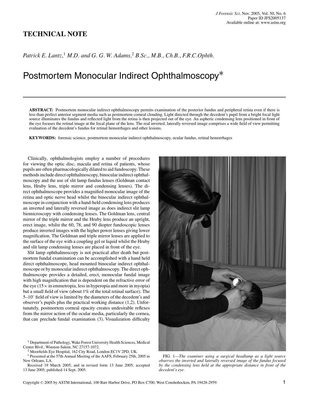 Postmortem monocular indirect ophthalmoscopy by Lantz PE Adams GG