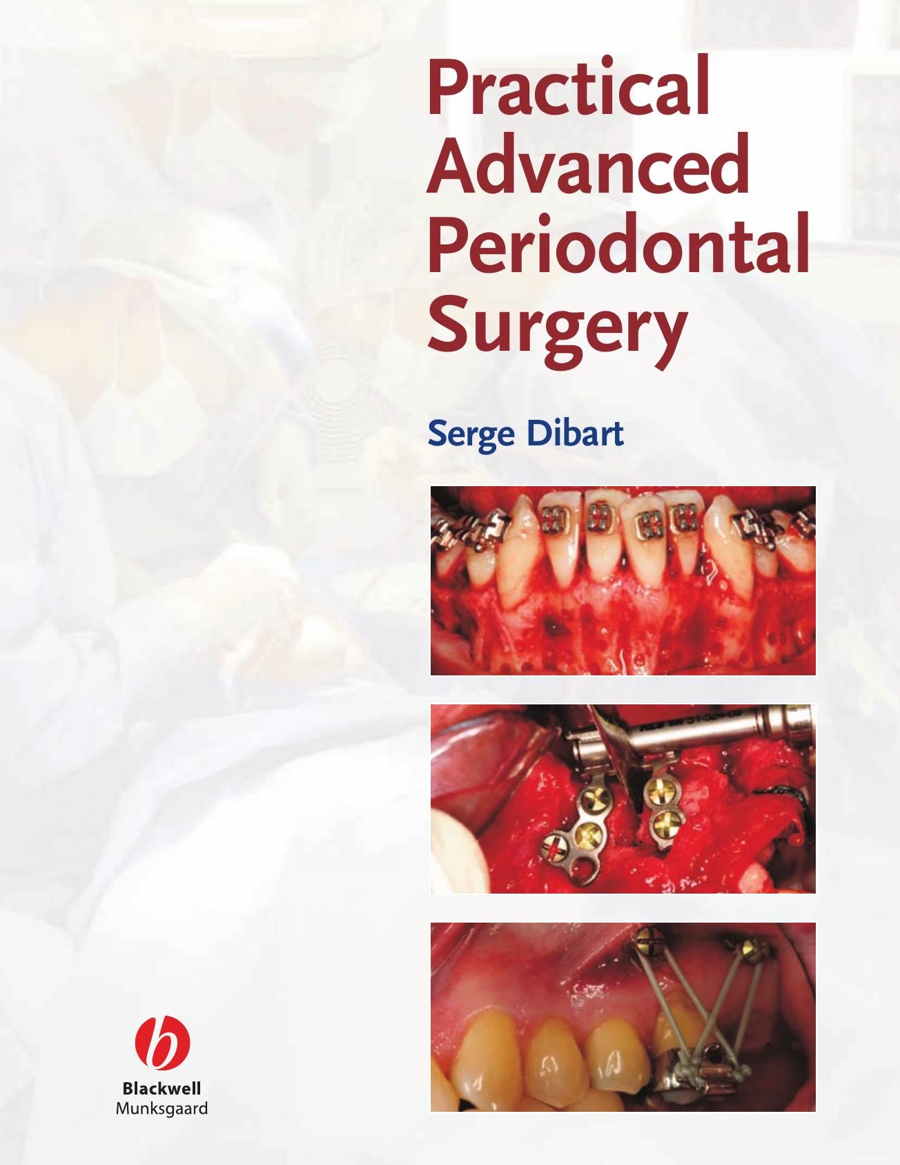 Practical Advanced Periodontal Surgery by Serge Dibart