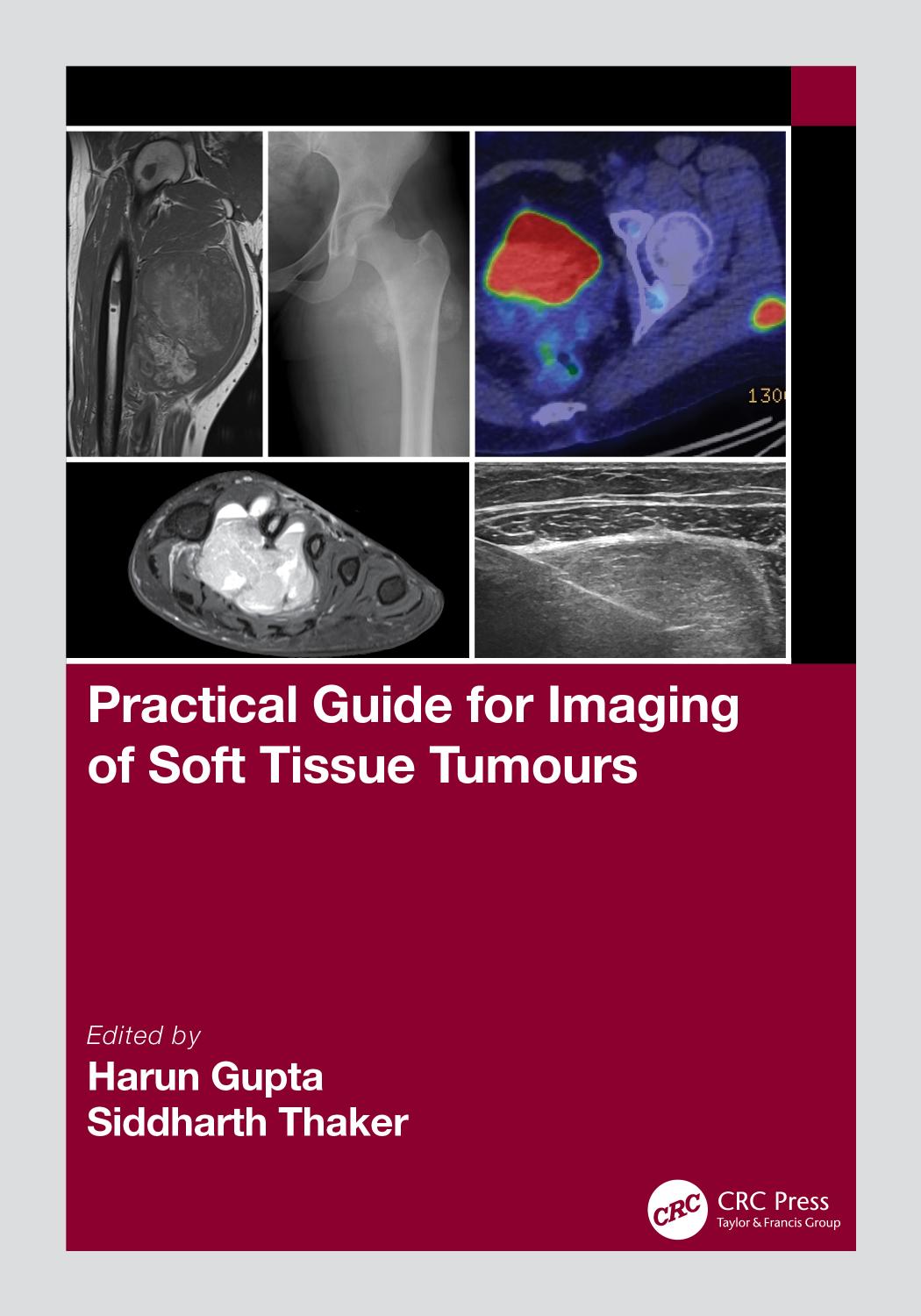 Practical Guide for Imaging of Soft Tissue Tumours by Harun Gupta Siddharth Thaker