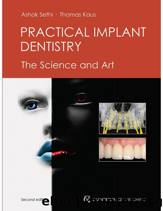 Practical Implant Dentistry by The Science & Art