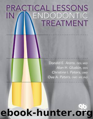 Practical Lessons in Endodontic Treatment by Donald E. Arens Alan H. Gluskin Christine I. Peters