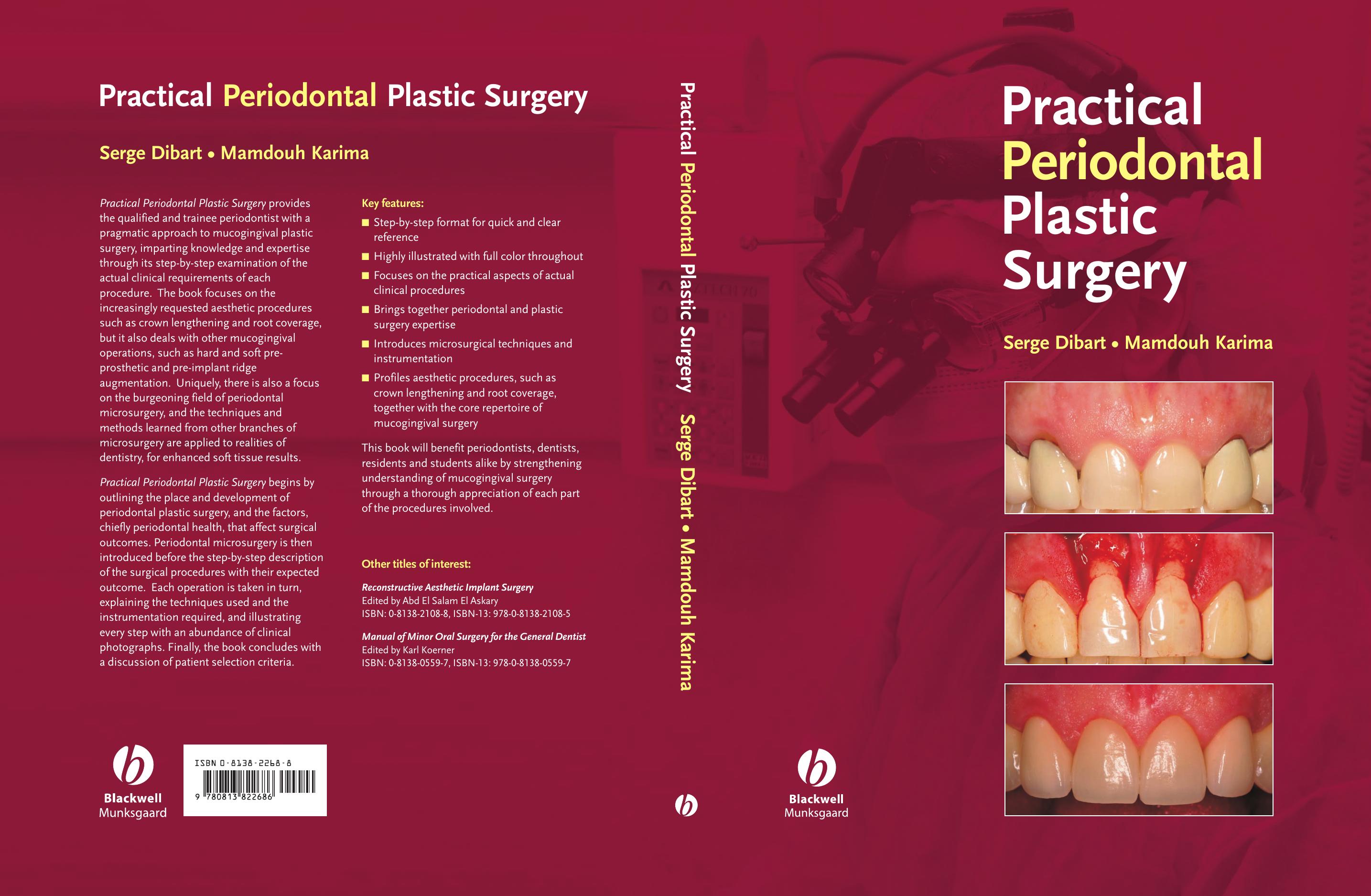 Practical Periodontal Plastic Surgery by Unknown