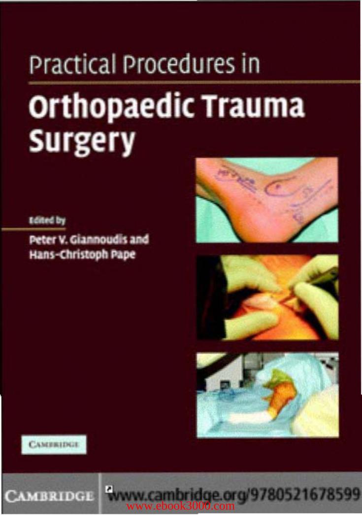 Practical Procedures in Orthopaedic Trauma Surgery: A Trainee's Companion by Unknow