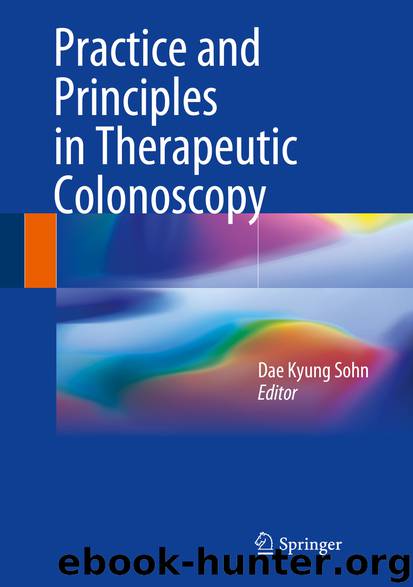 Practice and Principles in Therapeutic Colonoscopy by Dae Kyung Sohn
