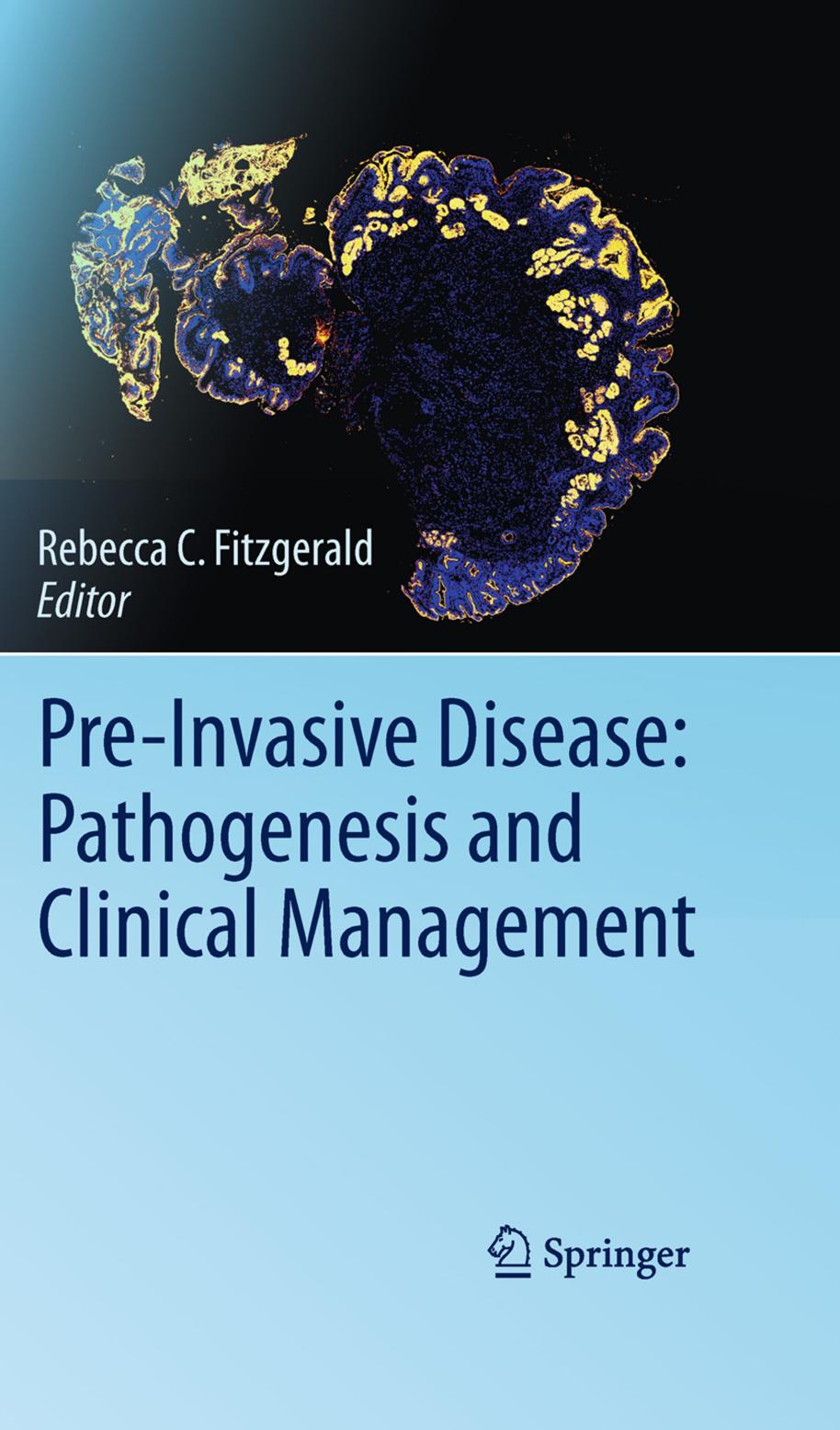 Pre-Invasive Disease: Pathogenesis and Clinical Management by Nicholas A. Wright (auth.) Rebecca C. Fitzgerald (eds.)