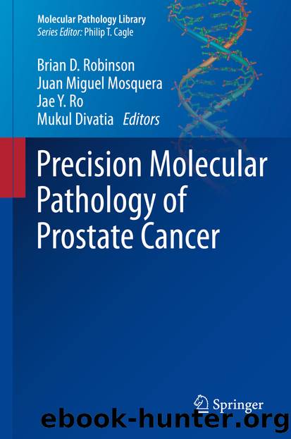 Precision Molecular Pathology of Prostate Cancer by Brian D. Robinson Juan Miguel Mosquera Jae Y. Ro & Mukul Divatia