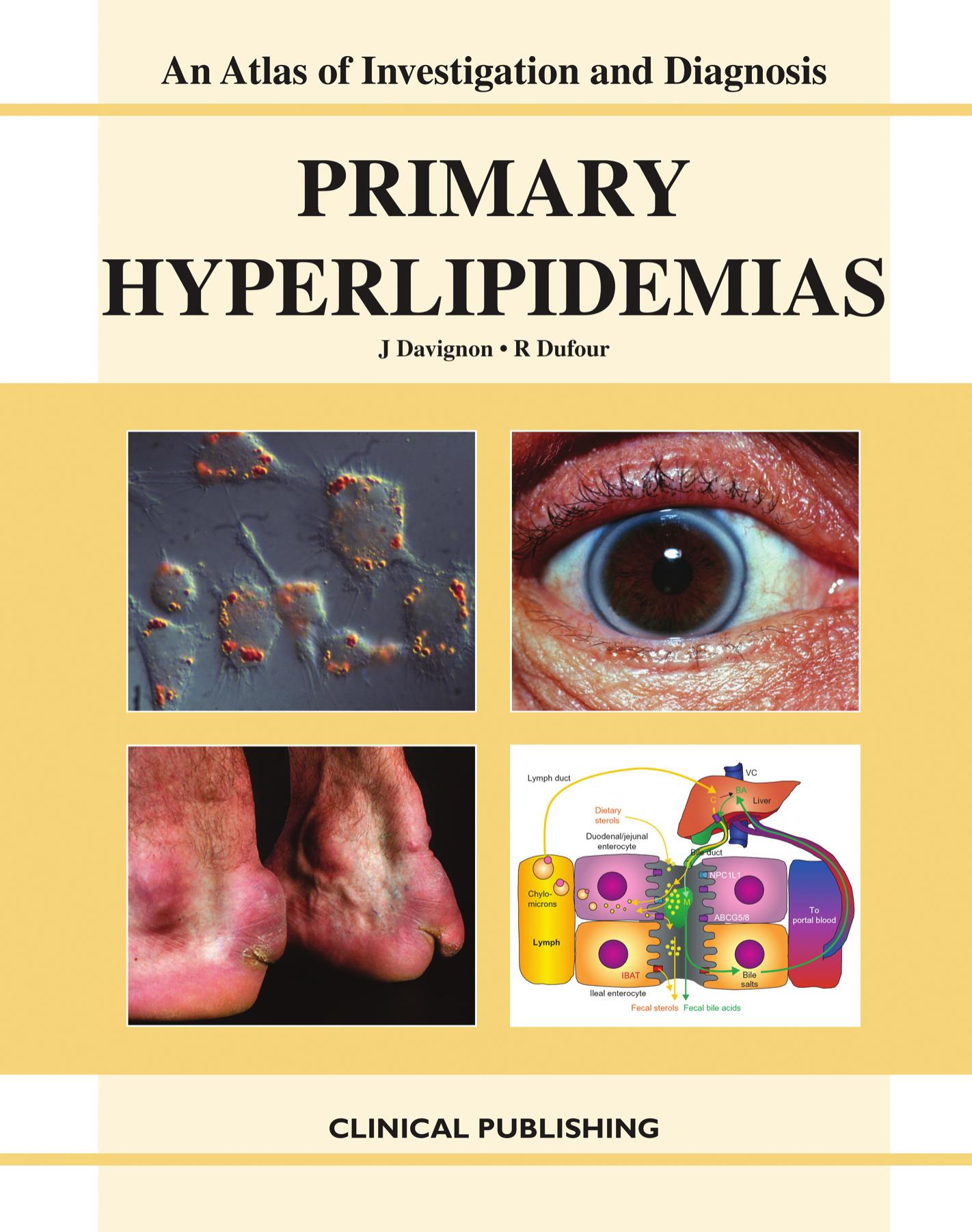 Primary Hyperlipidemias: An Atlas Of Investigation And Diagnosis by J. Davignon R. Dufour