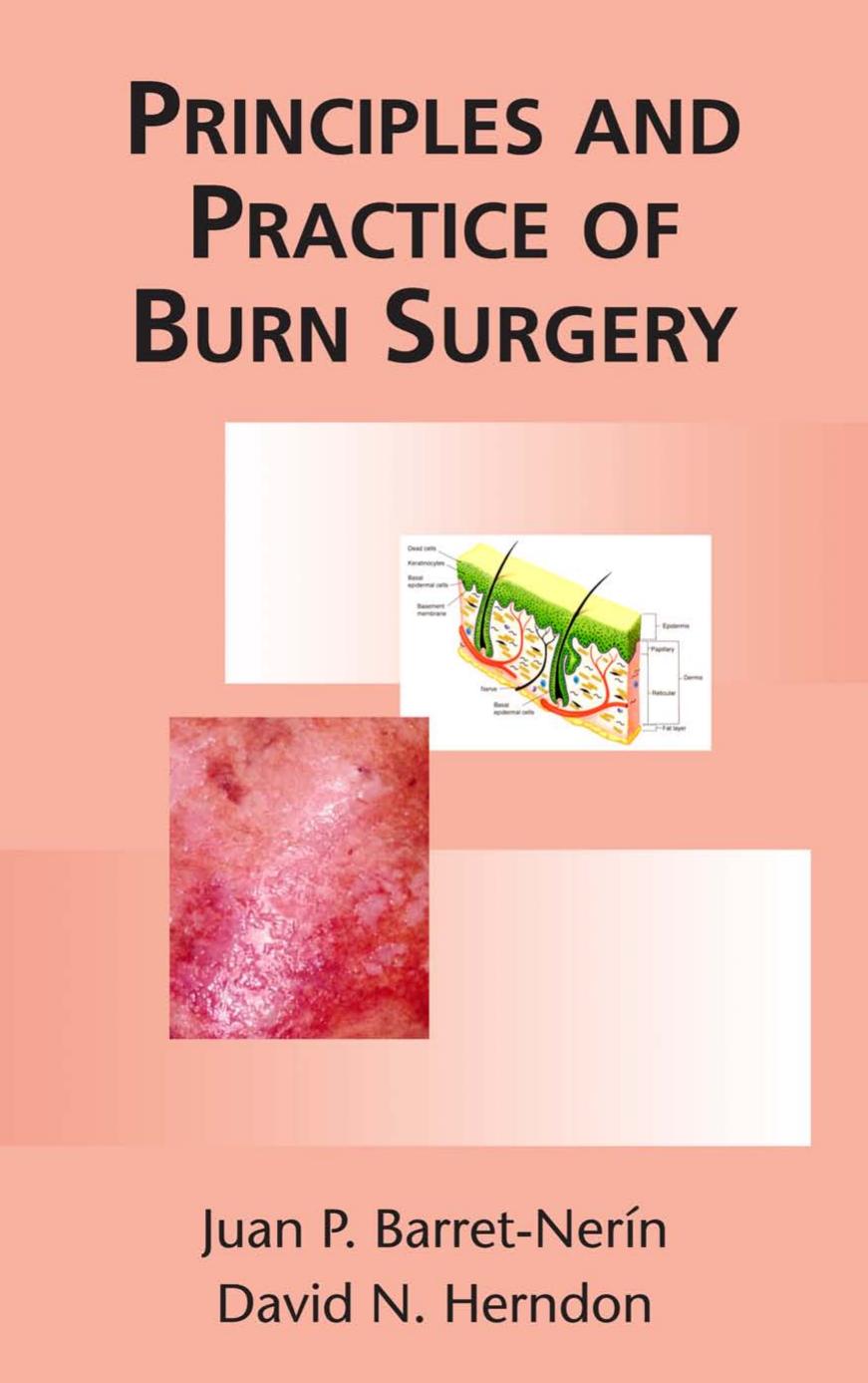 Principles and Practice of Burn Surgery by Juan Barret-Nerin (Editor) David N. Herndon (Editor)