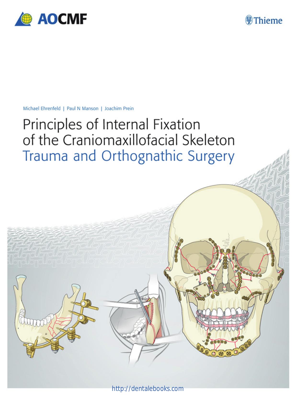 Principles of Internal Fixation of the Craniomaxillofacial Skeleton: Trauma and Othognathic Surgery by Joachim Prein Michael Ehrenfeld Paul N. Manson