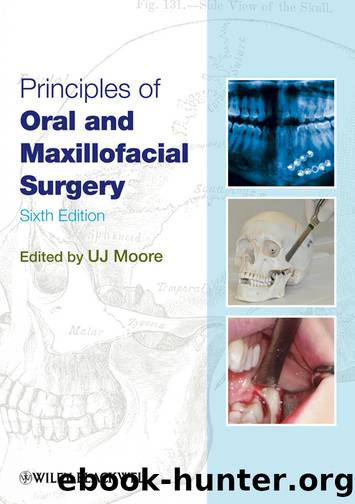 Principles of Oral and Maxillofacial Surgery by Moore U. J.;