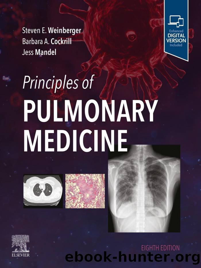 Principles of Pulmonary Medicine by unknow