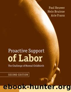 Proactive Support of Labor : The Challenge of Normal Childbirth (9781316409589) by Reuwer Paul; Bruinse Hein; Franx Arie & Reuwer Paul & Bruinse Hein & Franx Arie