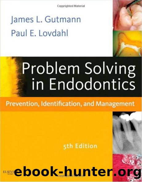Problem Solving in Endodontics by Prevention Identification & Management 5E (2011)