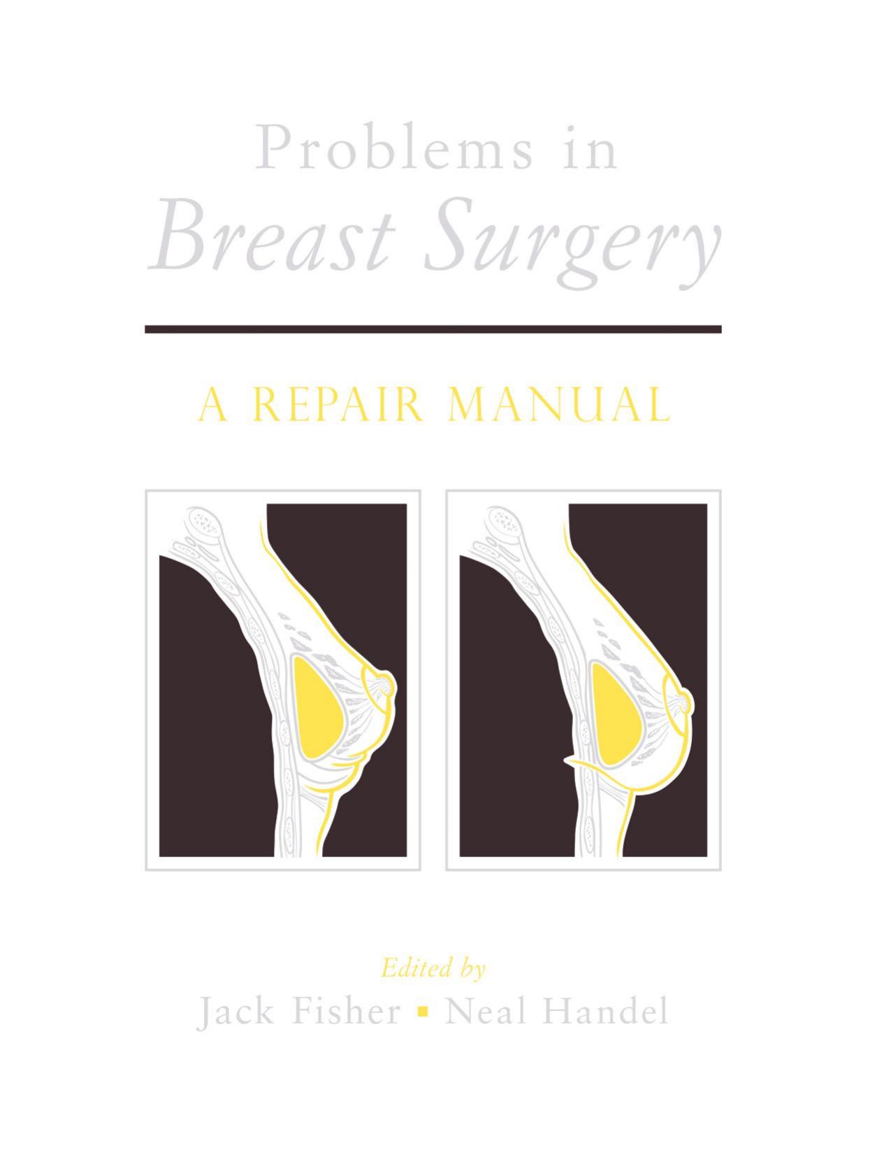 Problems in Breast Surgery : A Repair Manual by Fisher Jack; Handel Neal