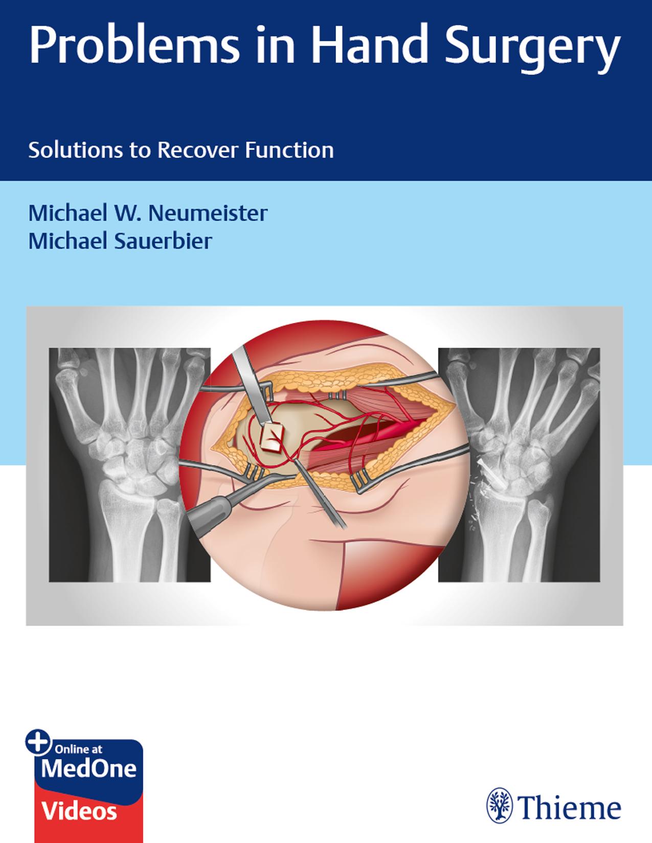 Problems in Hand Surgery: Solutions to Recover Function by Michael Neumeister (editor) Michael Sauerbier (editor)