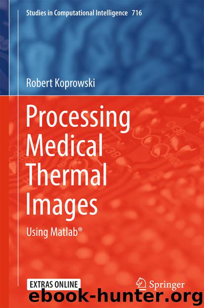 Processing Medical Thermal Images by Robert Koprowski