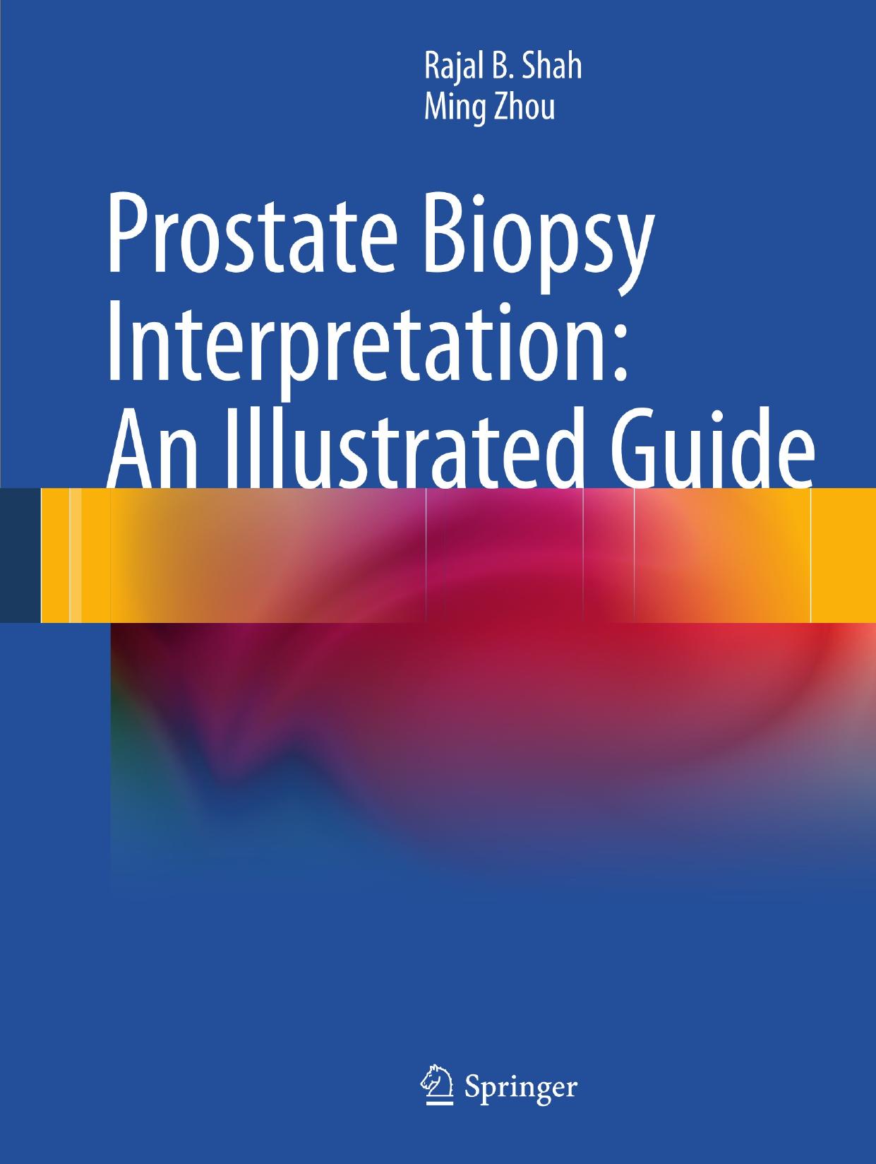 Prostate Biopsy Interpretation: An Illustrated Guide by Rajal B. Shah Ming Zhou (auth.)