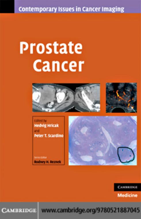 Prostate Cancer (Contemporary Issues in Cancer Imaging) by Hedvig Hricak Peter Scardino