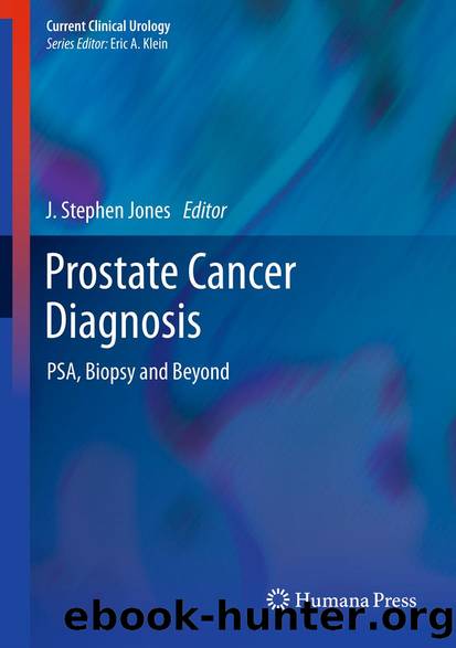 Prostate Cancer Diagnosis by J. Stephen Jones