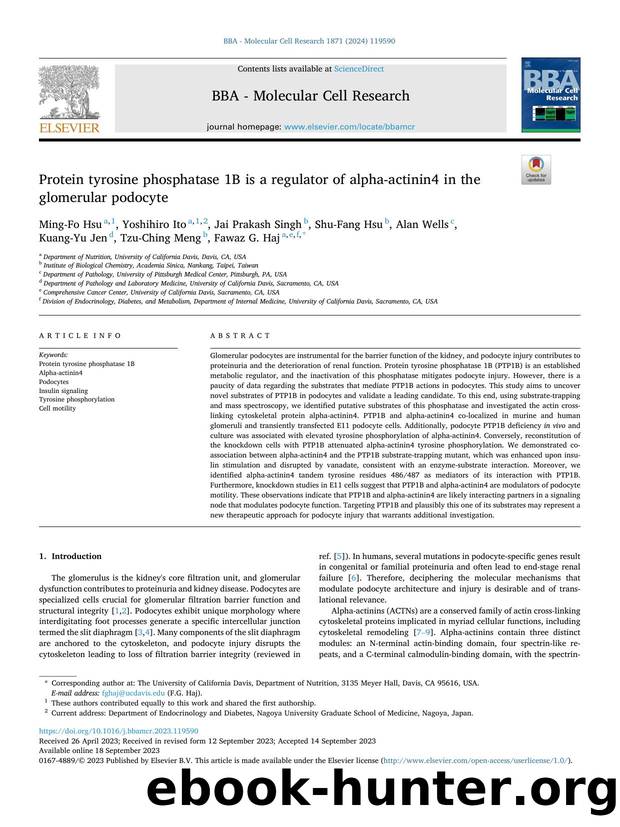 Protein tyrosine phosphatase 1B is a regulator of alpha-actinin4 in the glomerular podocyte by unknow