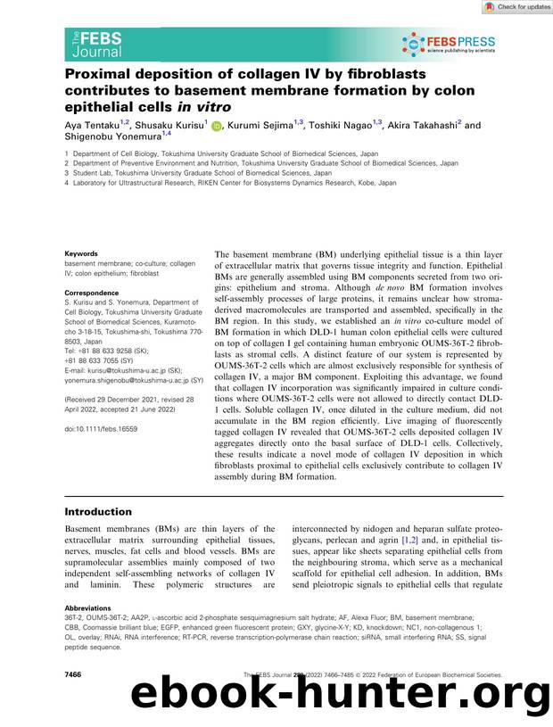Proximal deposition of collagen IV by fibroblasts contributes to basement membrane formation by colon epithelial cells inâvitro by Unknown