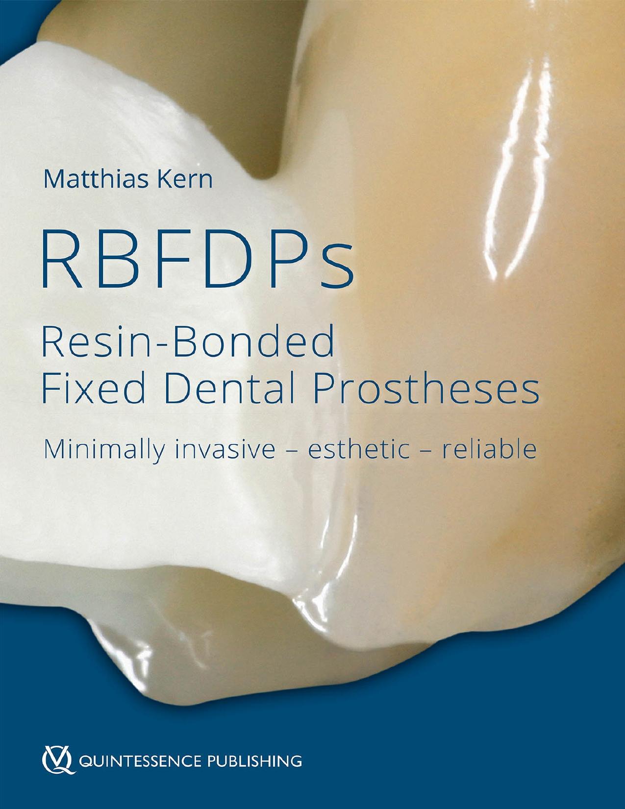 RBFDPs : resin-bonded fixed dental prostheses : minimally invasive, esthetic, reliable by Matthias Kern