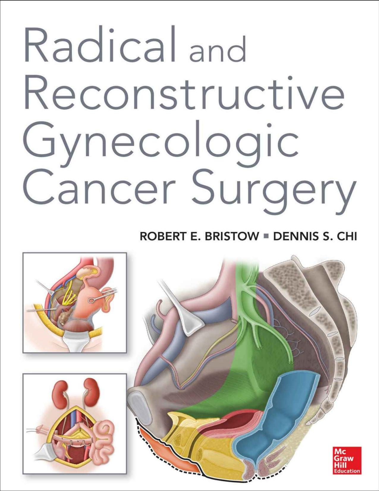 Radical and Reconstructive Gynecologic Cancer Surgery by Robert E. Bristow Dennis Chi