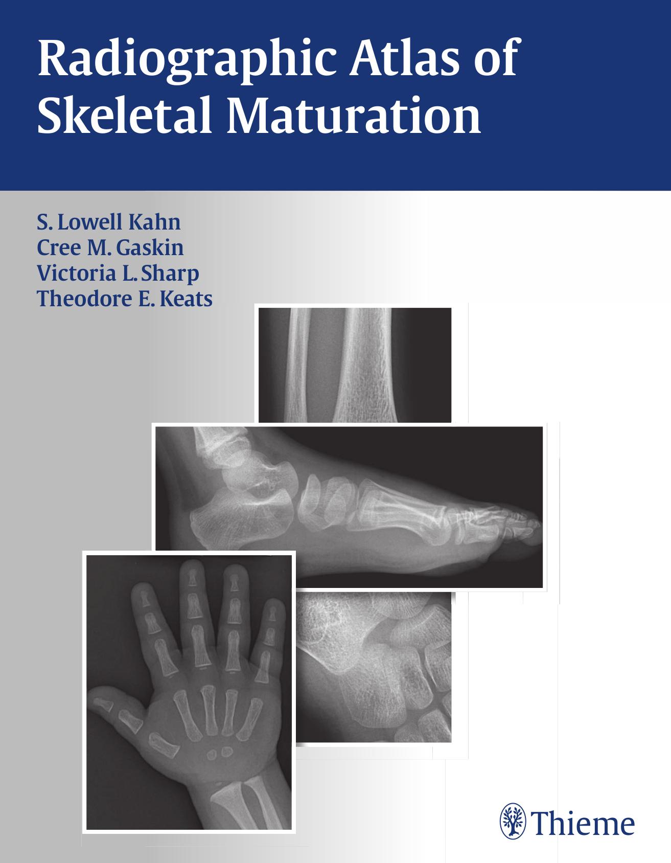 Radiographic atlas of skeletal maturation by S. Lowell Kahn Cree M. Gaskin Victoria L. Sharp Theodore Eliot Keats Bing Li