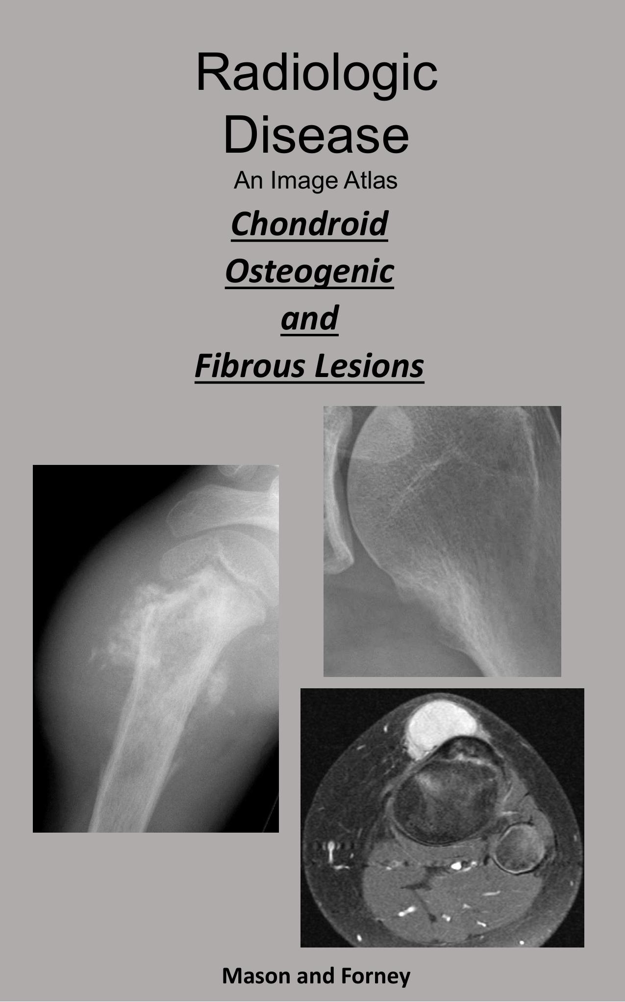 Radiologic Disease. An Imaging Atlas: Chondroid, Osteogenic, and Fibrous Lesions by Unknow