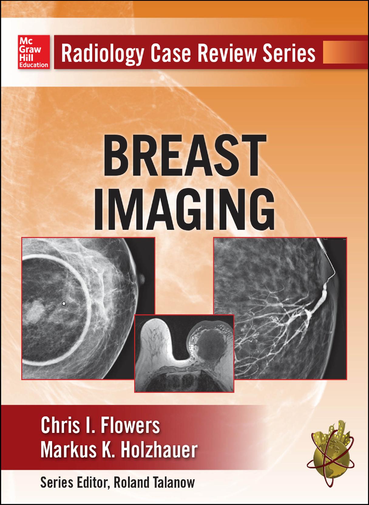 Radiology Case Review Series: Breast Imaging by Flowers Chris; Holzhauer Markus K