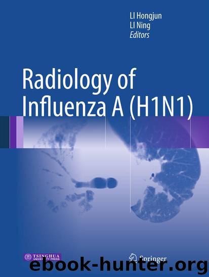 Radiology of Influenza A (H1N1) by Hongjun Li & Ning Li
