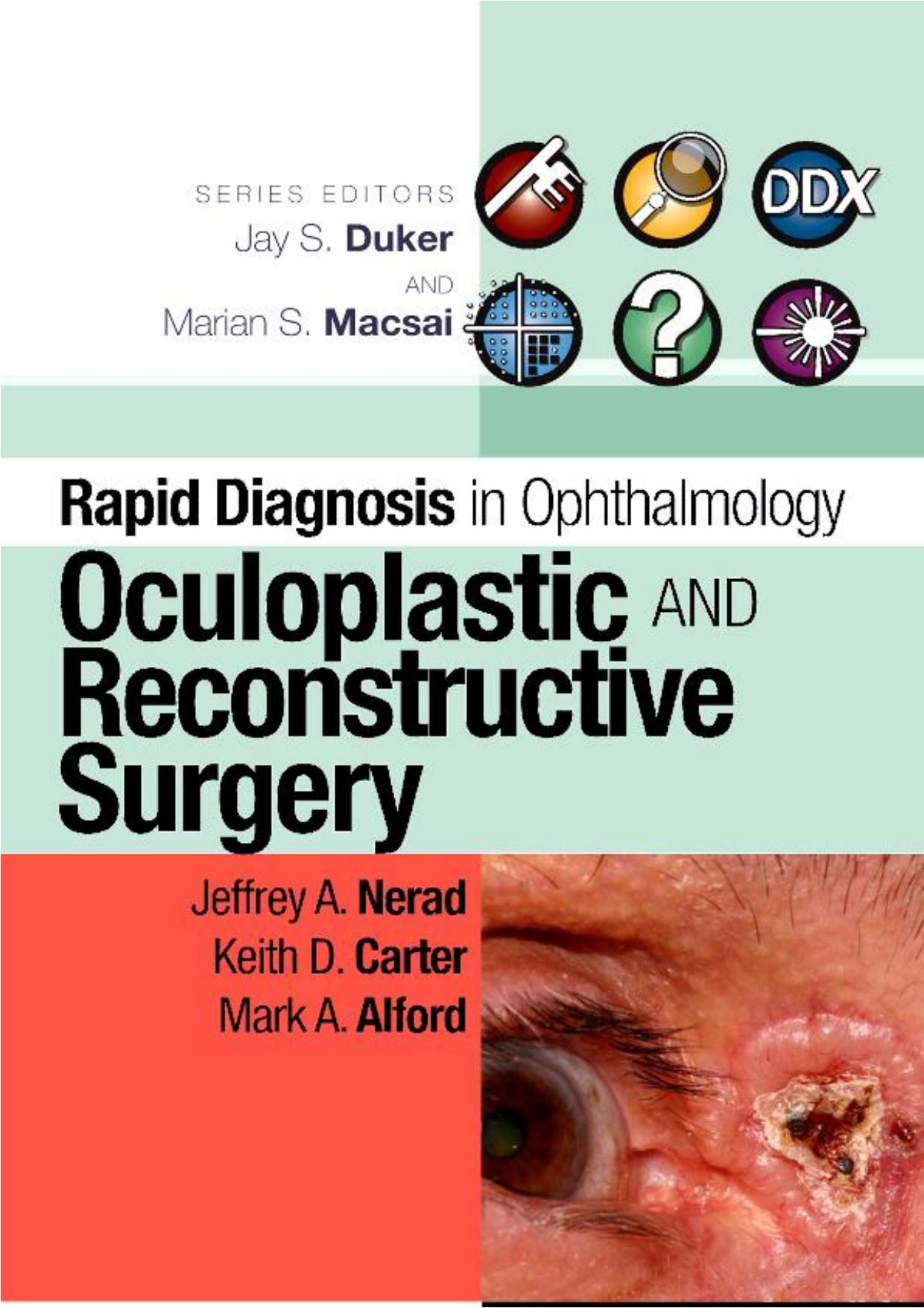 Rapid Diagnosis in Ophthalmology Series: Oculoplastic and Reconstructive Surgery (Rapid Diagnoses in Ophthalmology) by Jeffrey A. Nerad MD Keith D. Carter Mark Alford