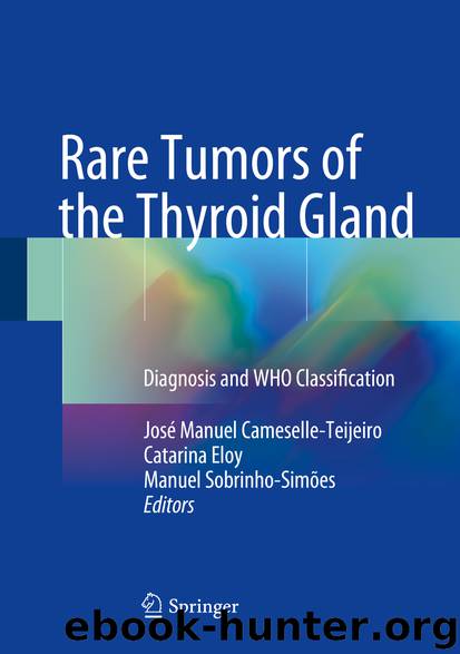 Rare Tumors of the Thyroid Gland by José Manuel Cameselle-Teijeiro Catarina Eloy & Manuel Sobrinho-Simões