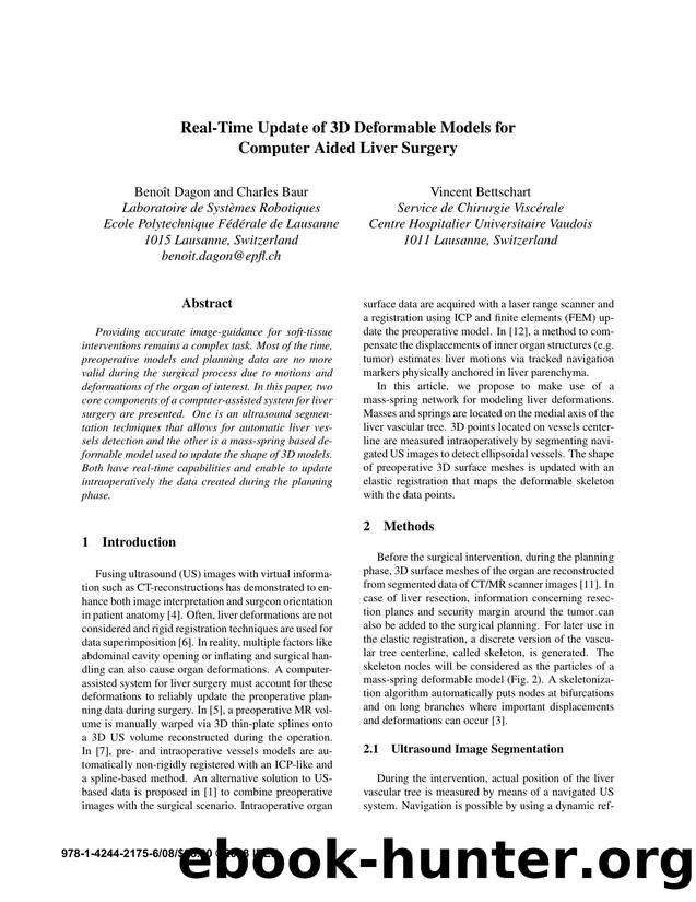 Real-Time Update of 3D Deformable Models for Computer Aided Liver Surgery by 