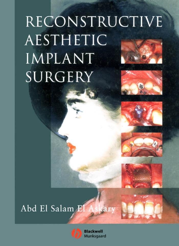 Reconstructive Aesthetic Implant Surgery by Unknow