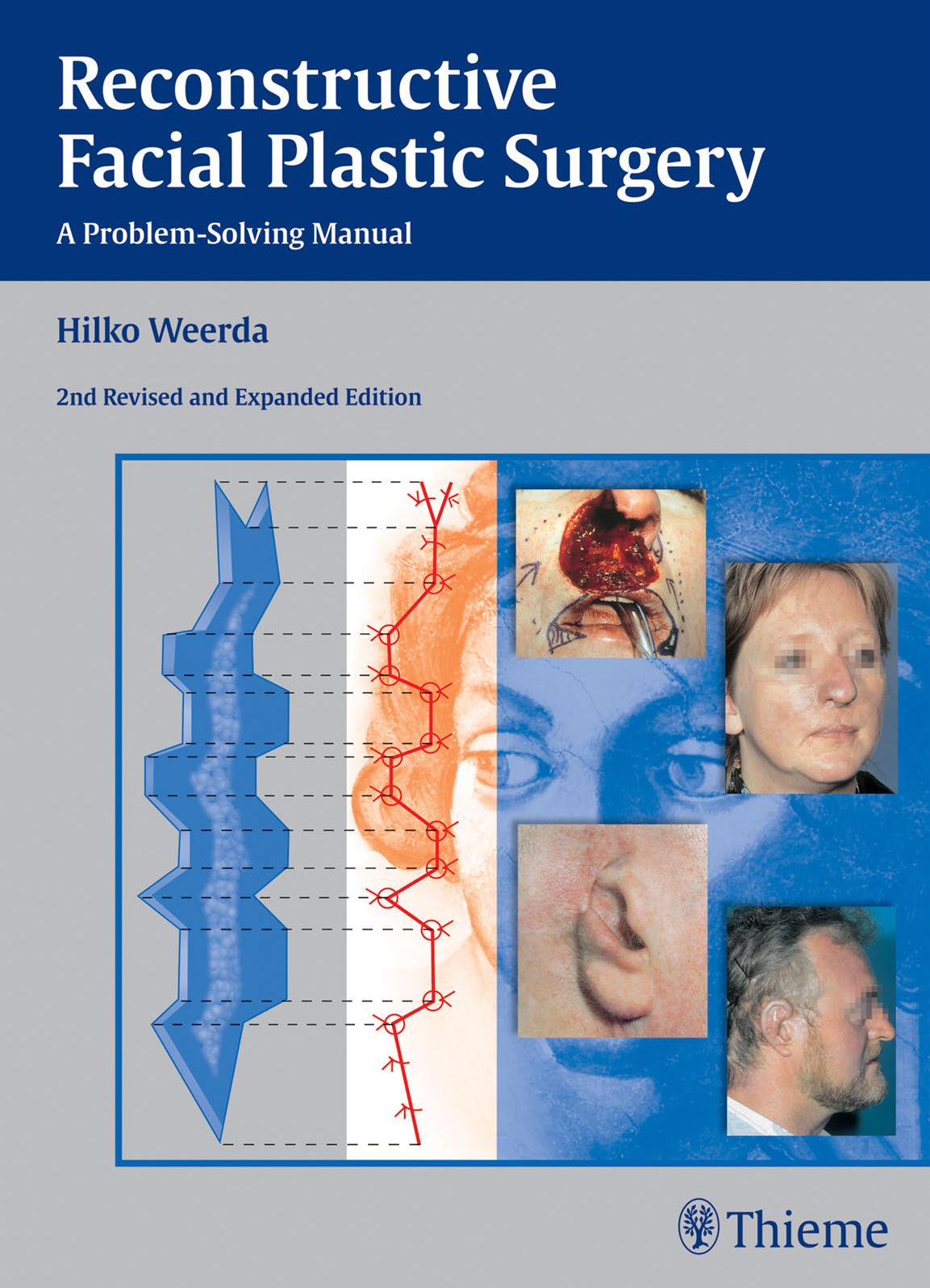 Reconstructive Facial Plastic Surgery: A Problem-Solving Manual Ed 2 by Unknow
