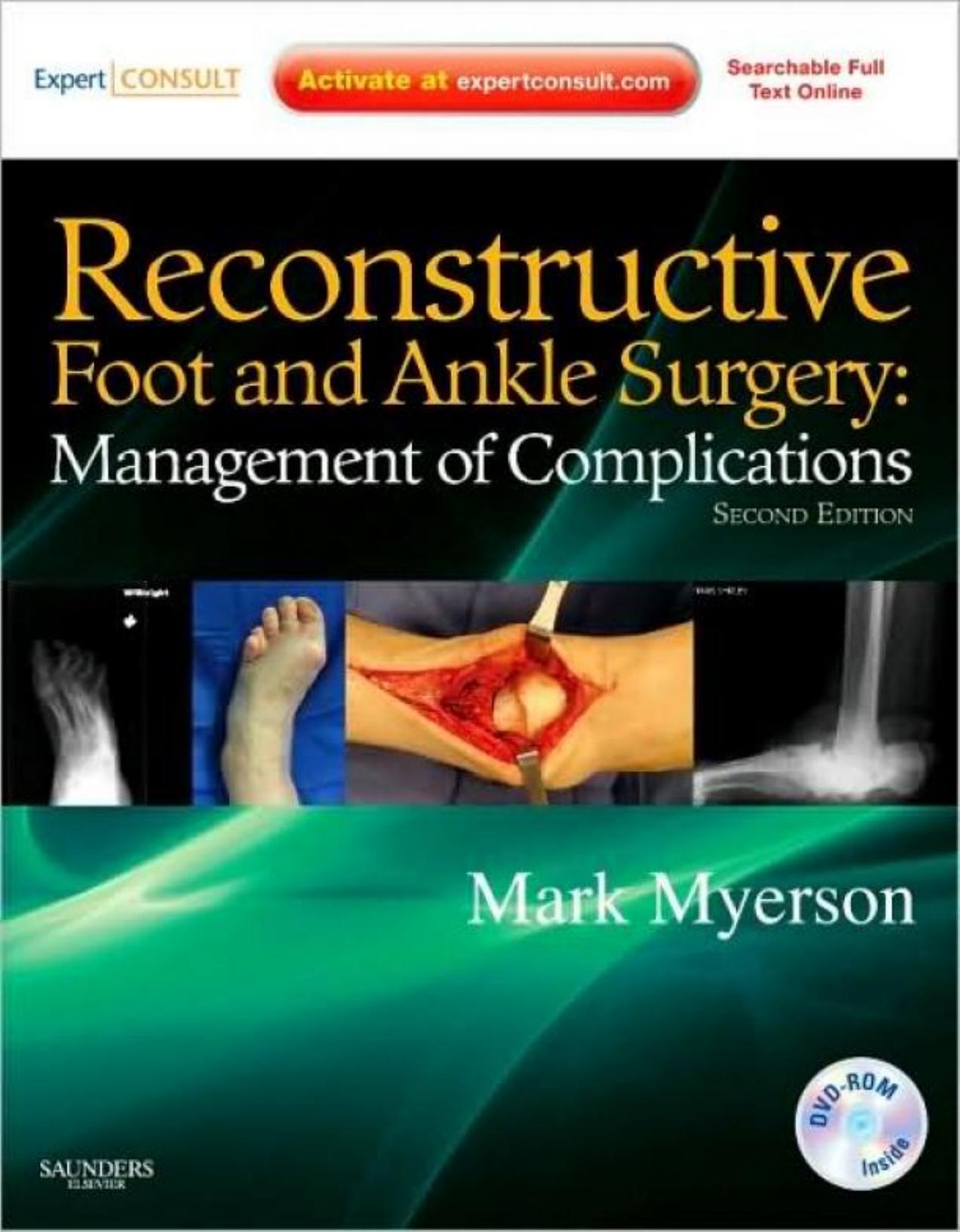 Reconstructive Foot and Ankle Surgery: Management of Complications: Expert Consult - Online, Print, Second Edition by Mark S. Myerson MD