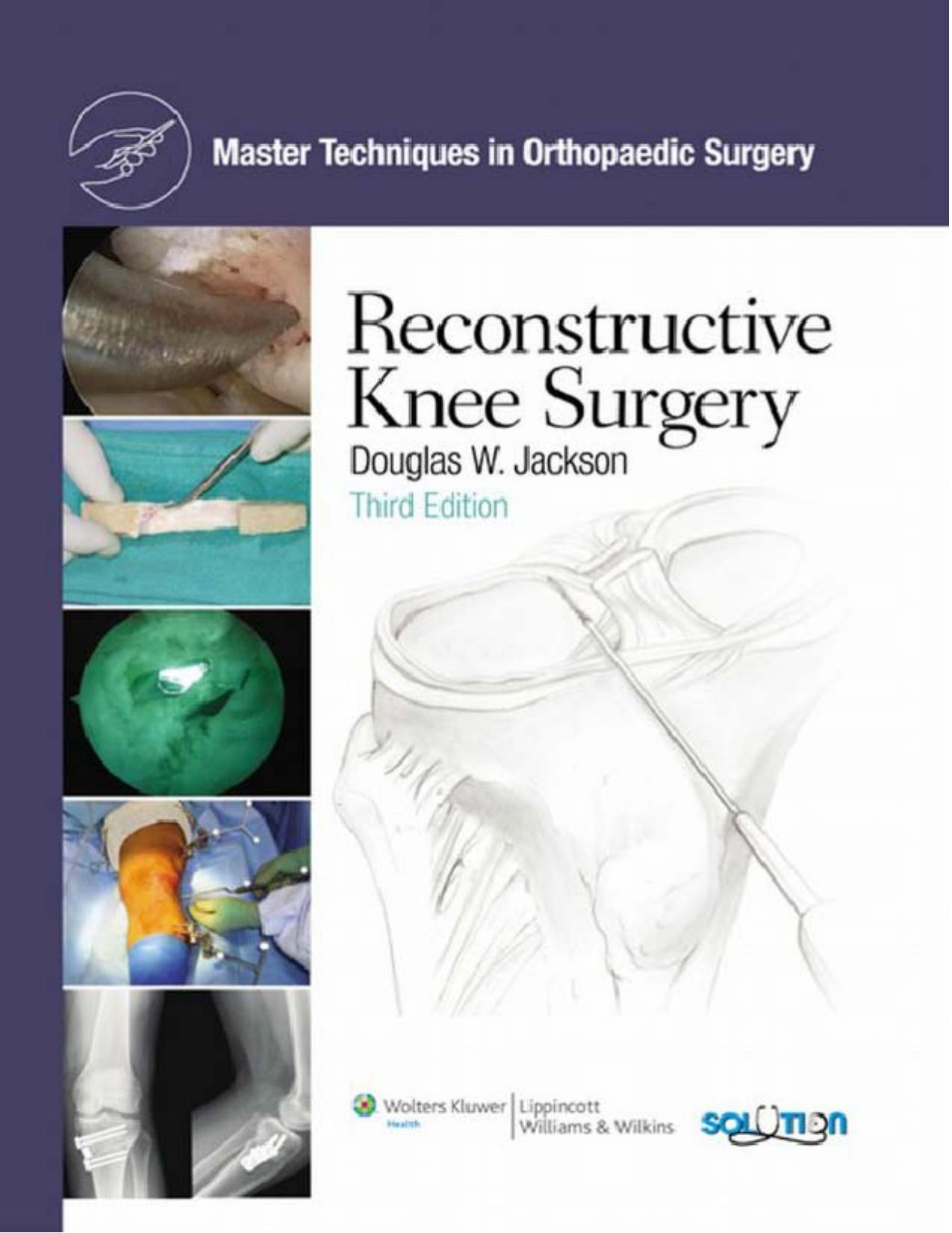 Reconstructive Knee Surgery by Douglas W. Jackson MD