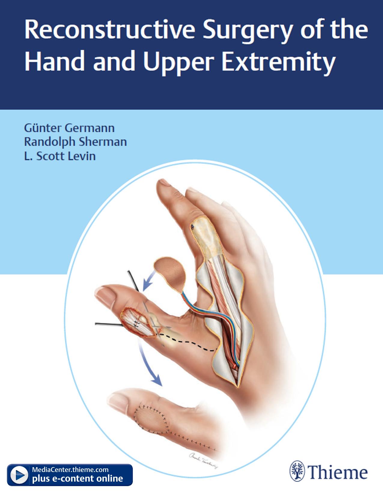 Reconstructive Surgery of the Hand and Upper Extremity by G Germann