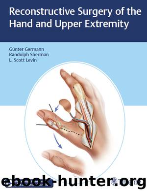 Reconstructive Surgery of the Hand and Upper Extremity by Germann Günter; Levin L. Scott; Sherman Randolph