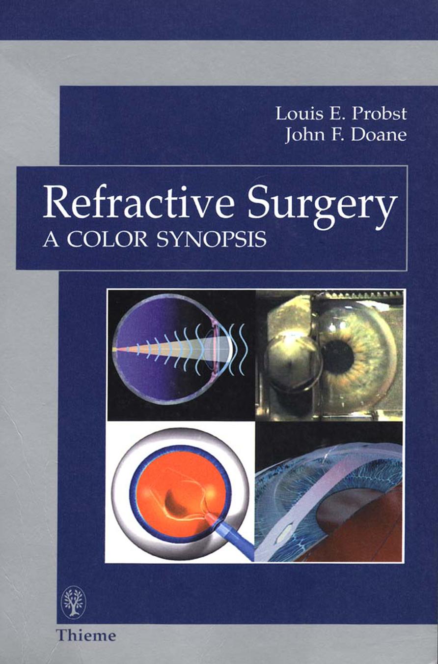 Refractive Surgery A Color Synopsis by Louis E. Probst and John F. Doane