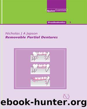 Removable Partial Dentures by Jepson Nicholas J. A