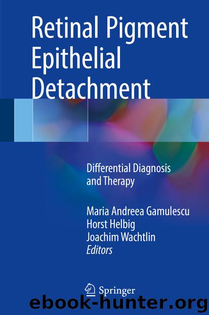 Retinal Pigment Epithelial Detachment by Maria Andreea Gamulescu Horst Helbig & Joachim Wachtlin