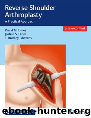 Reverse Shoulder Arthroplasty by Dines David M.;Dines Joshua;Edwards T. Bradley;
