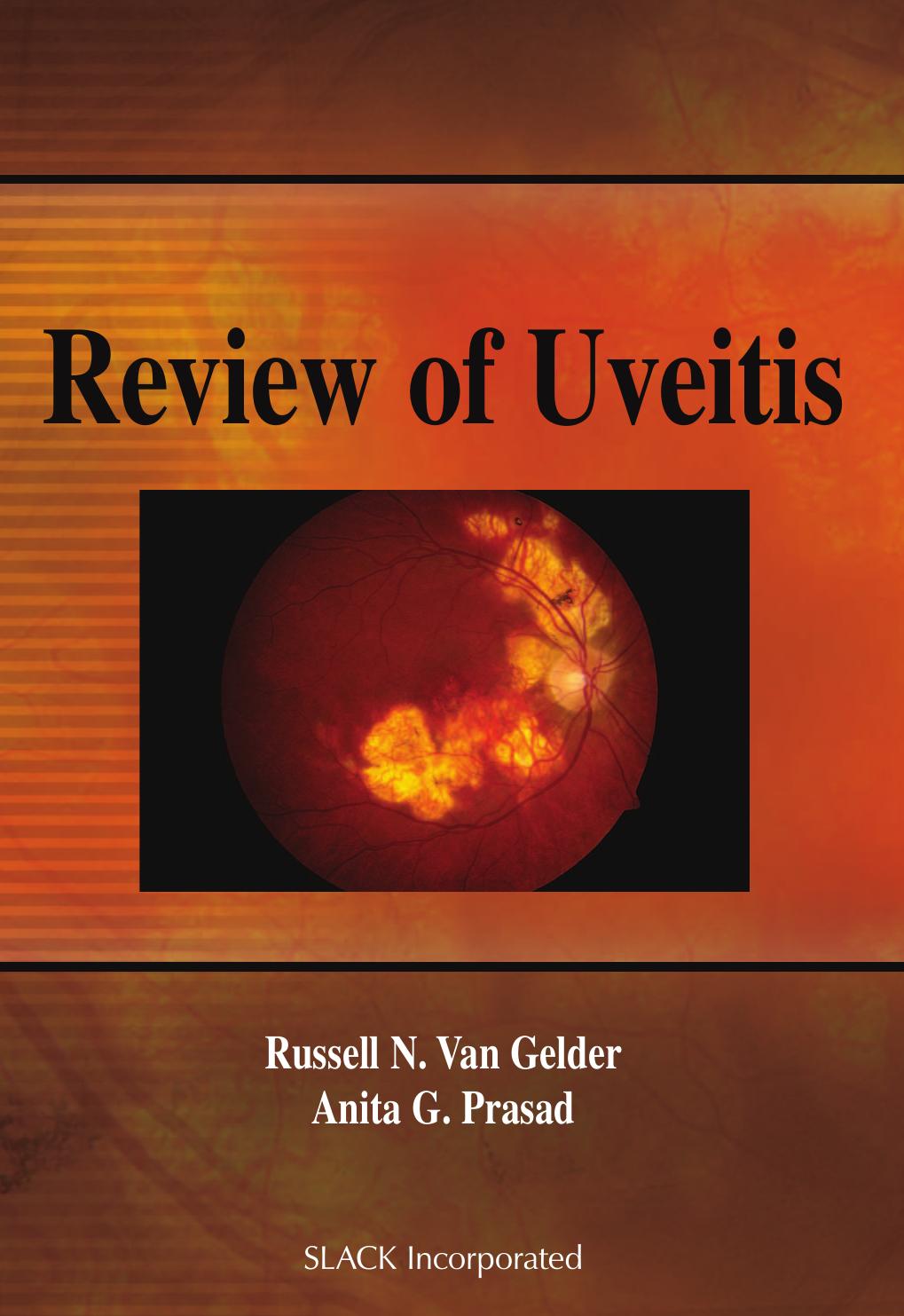 Review of Uveitis by Russell Van Gelder; Anita Prasad