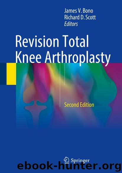 Revision Total Knee Arthroplasty by James V. Bono & Richard D. Scott