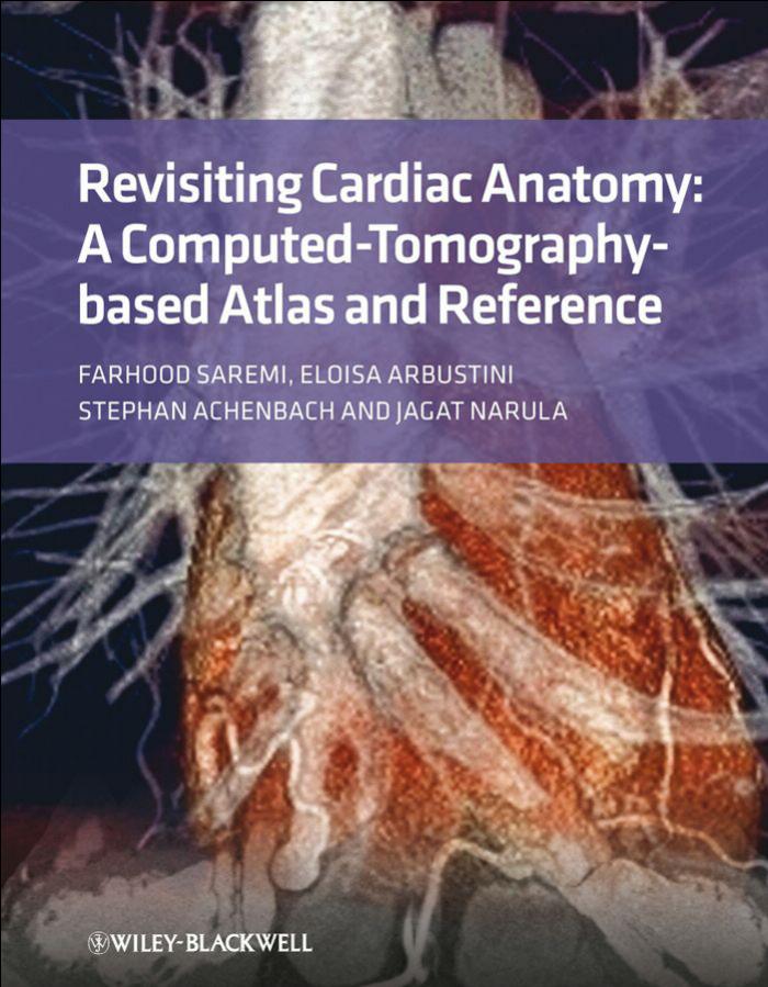 Revisiting Cardiac Anatomy: A Computed-Tomography-Based Atlas and Reference by Farhood Saremi