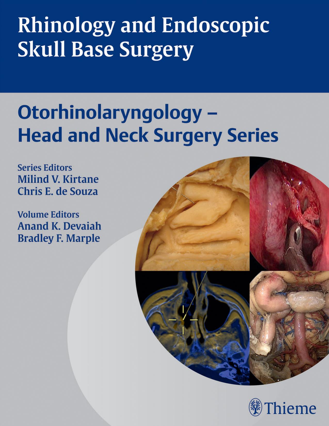 Rhinology and endoscopic skull base surgery by Devaiah Anand; Marple Bradley F