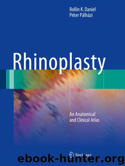 Rhinoplasty by Rollin K. Daniel & Péter Pálházi
