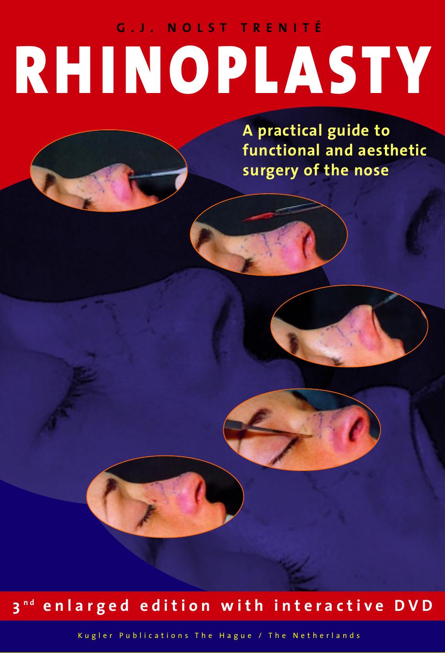 Rhinoplasty: A practical guide to functional and aesthetic surgery of the nose, 3rd Edition by Trenite Nolst